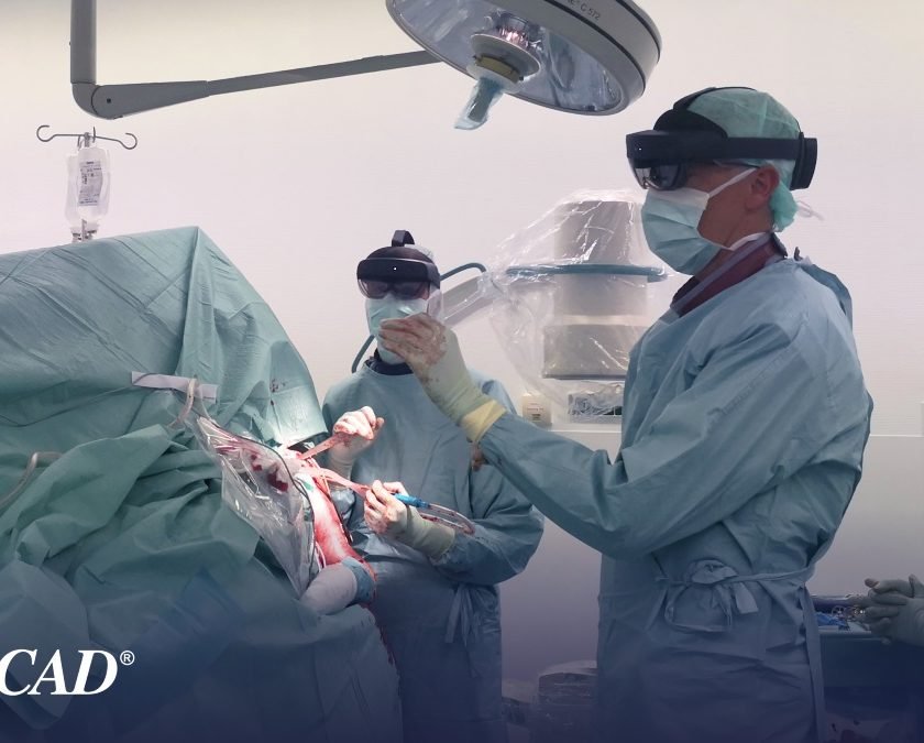 Das Leonberg Krankenhaus vollführt seine erste Schulteroperation mit mediCAD Mixed Reality